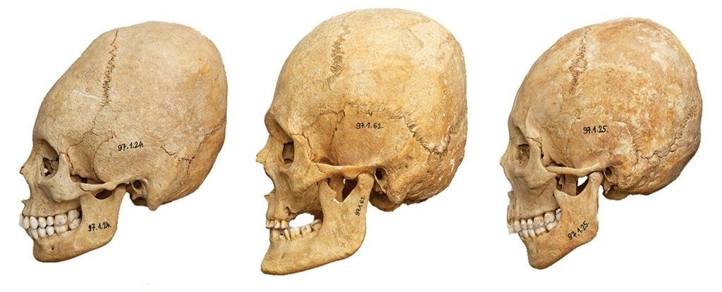 Click to enlarge cranial modification