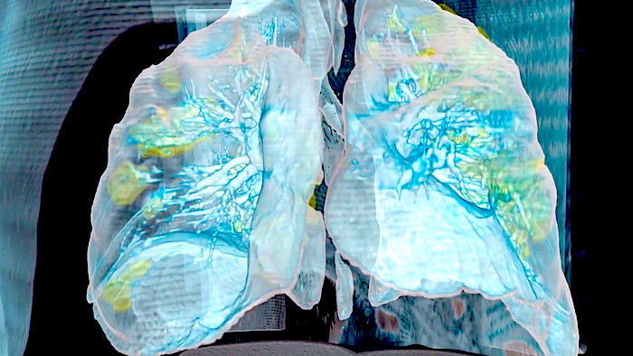 lungs