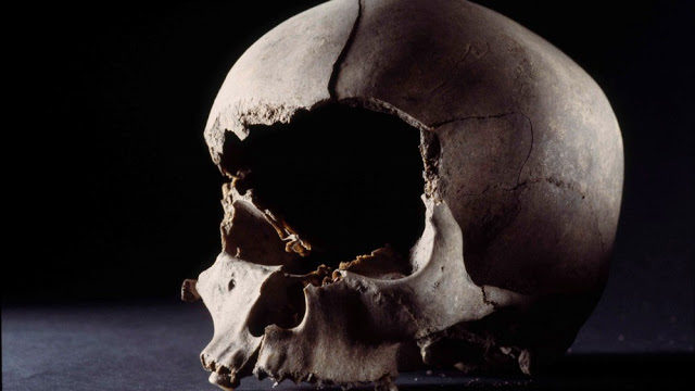 skull