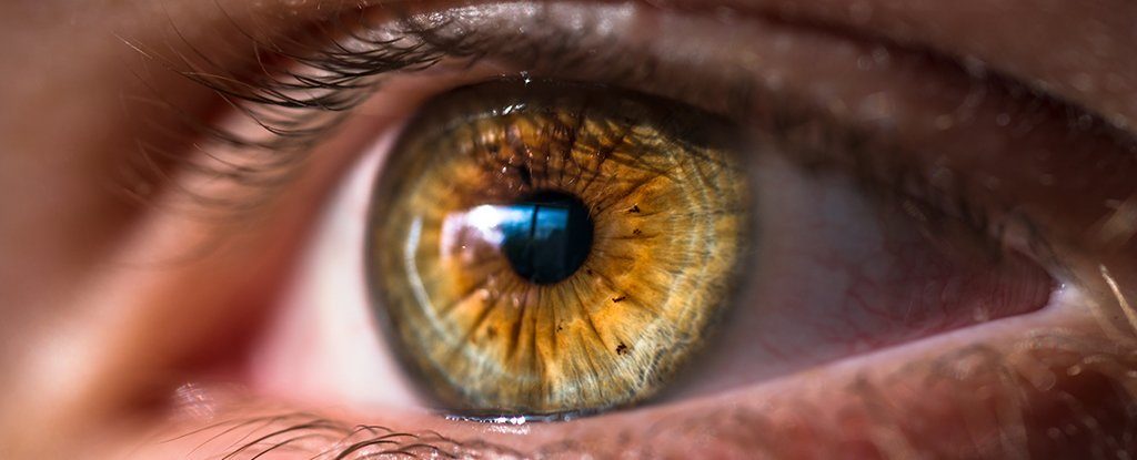 Click to enlarge eye brown