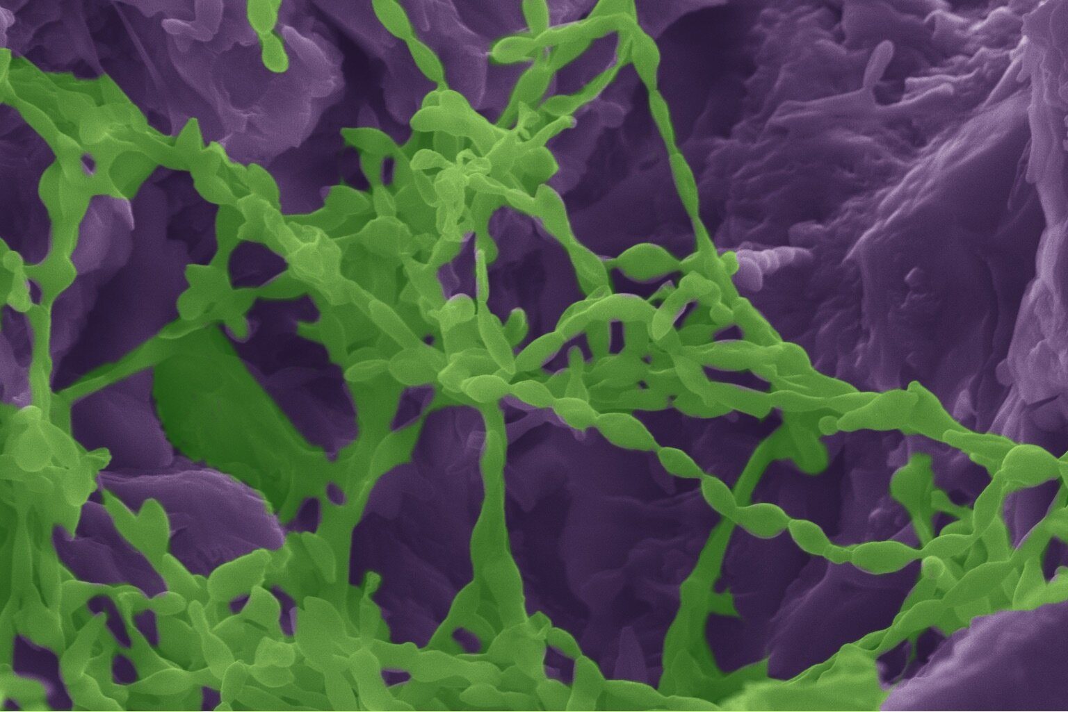 Click to enlarge Microorganisms