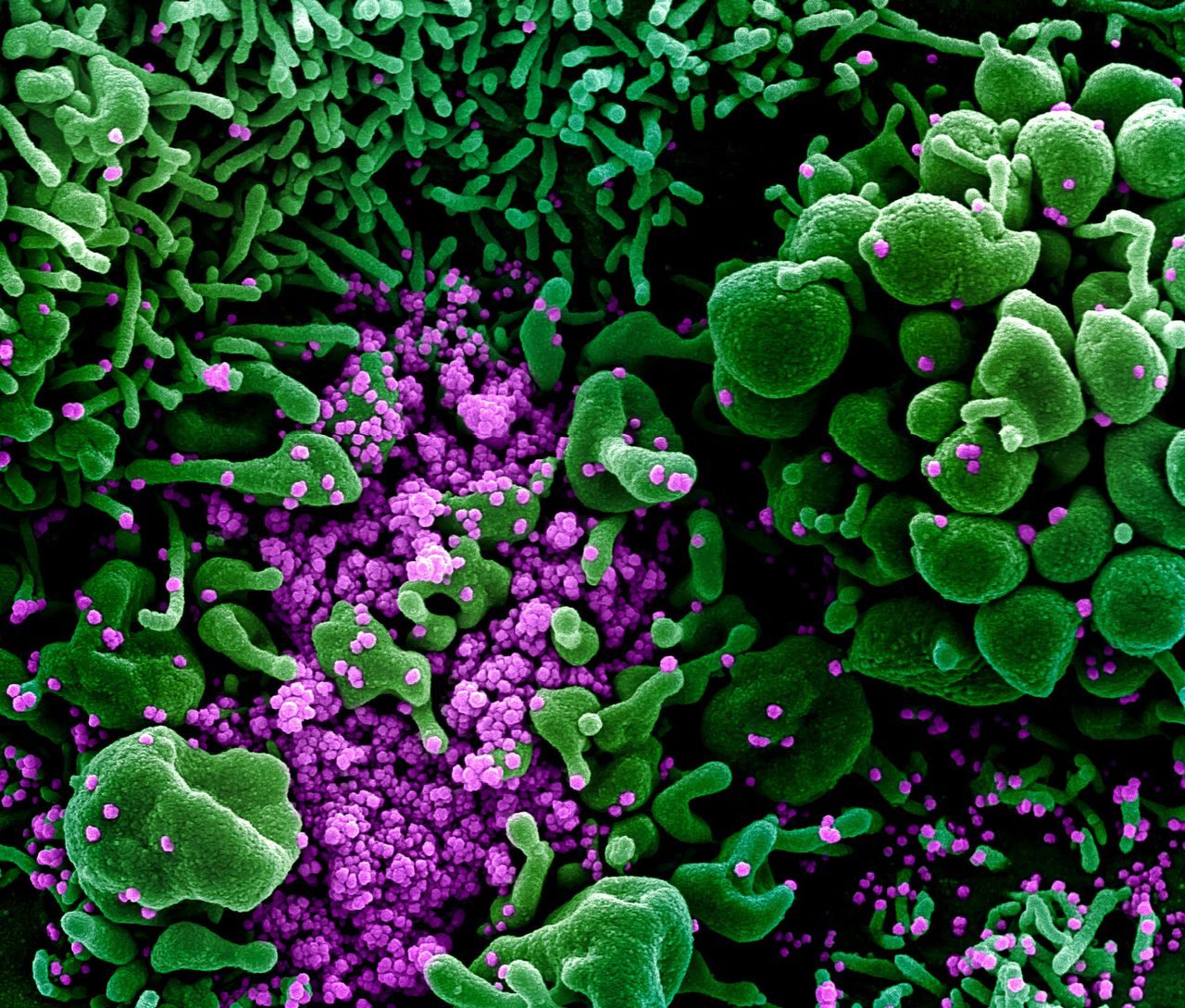 coronavirus