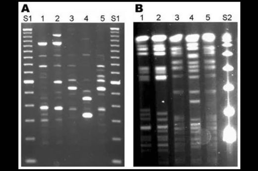 Was the COVID-19 test meant to detect a virus?