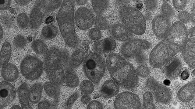 Click to enlarge Eija Pirinen; A. Wartiovaara's research group. AddThis Sharing Buttons Share to Facebook