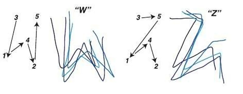 Click to enlarge Dynamic stimulation visual cortex