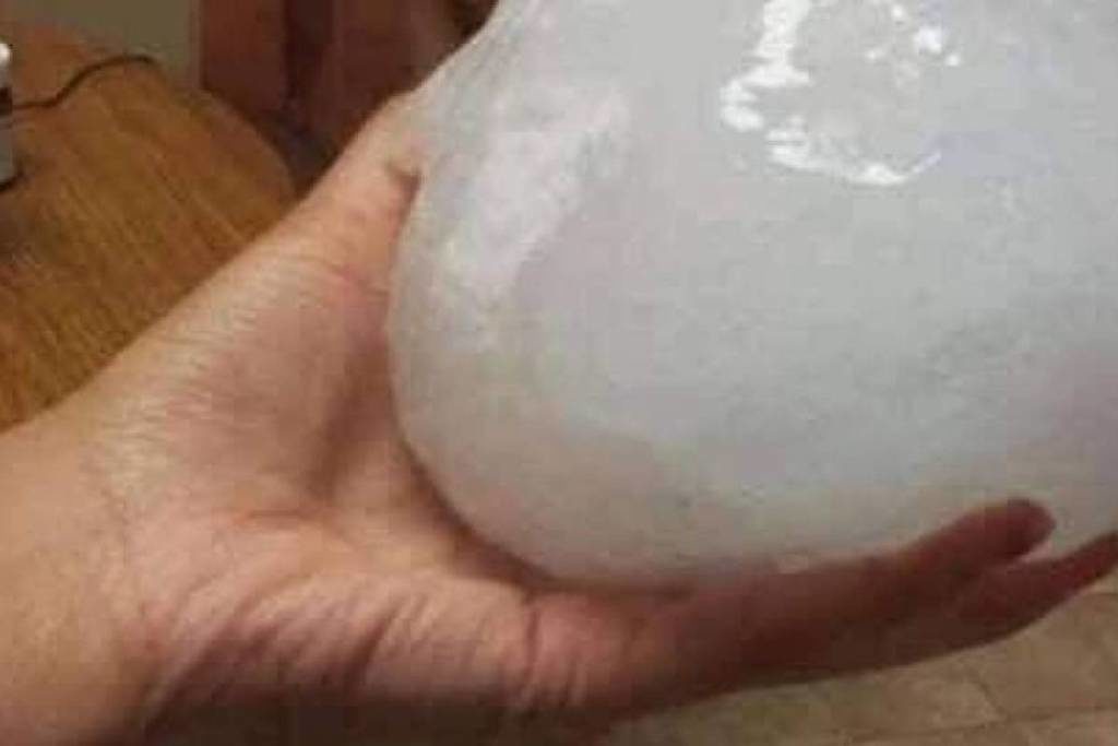 hail