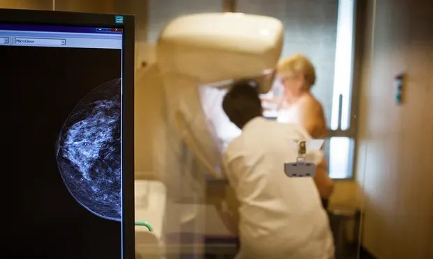 mammogram