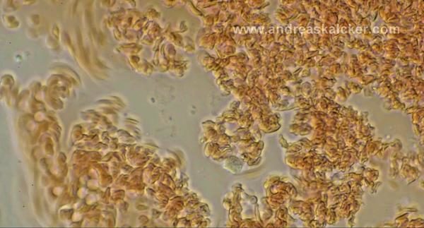 Click to enlarge blood cells