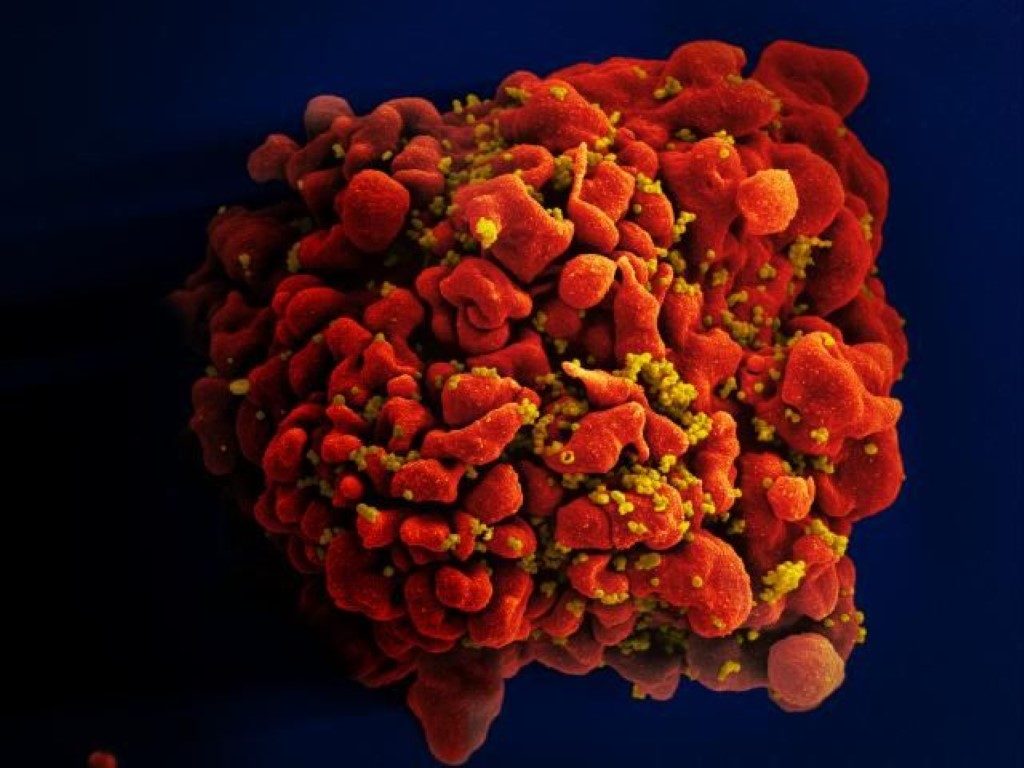 Click to enlarge cell HIV AIDS