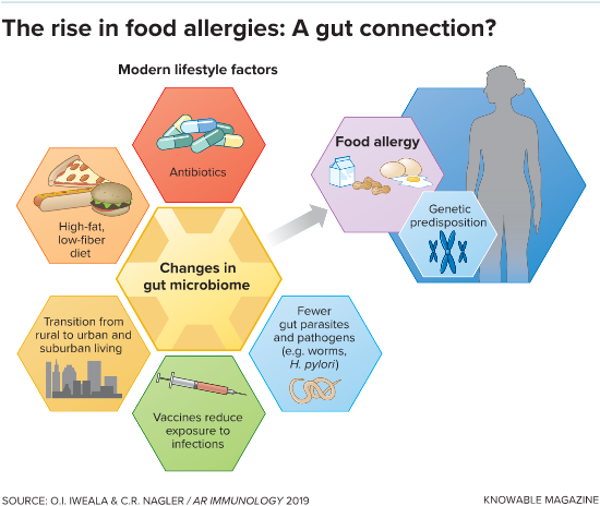 food allergies