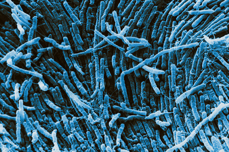 bacteria Clostridia