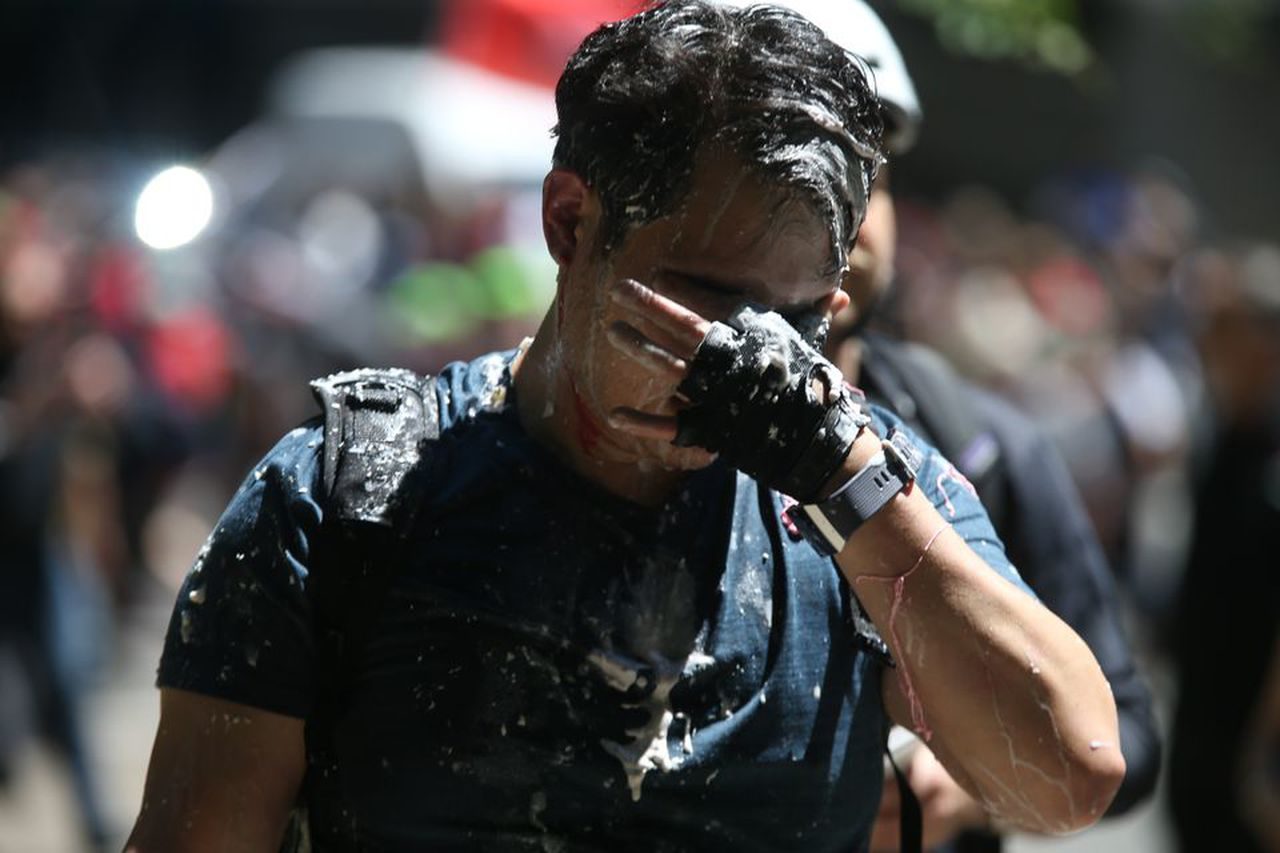 Click to enlarge andy ngo attacked antifa
