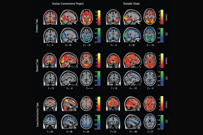Click to enlarge brain scans