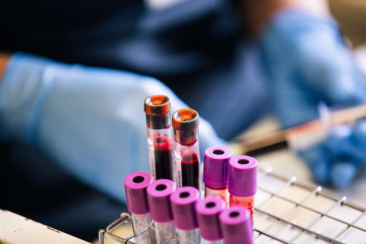 Click to enlarge blood samples coronavirus covid-19