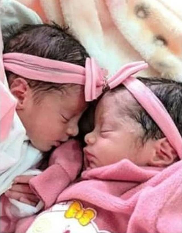 Click to enlarge The newborn sister twins died.