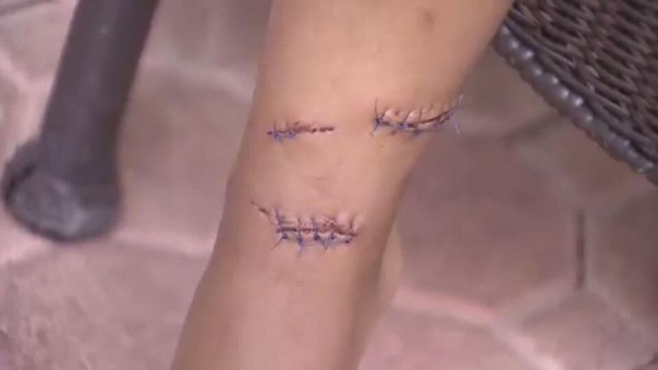 Click to enlarge stitches