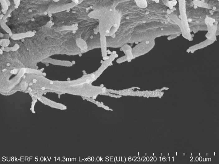 Click to enlarge coronavirus