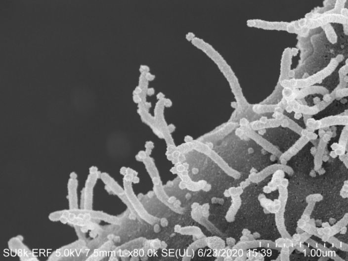 Click to enlarge coronavirus