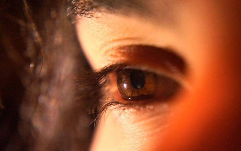 Click to enlarge eye red
