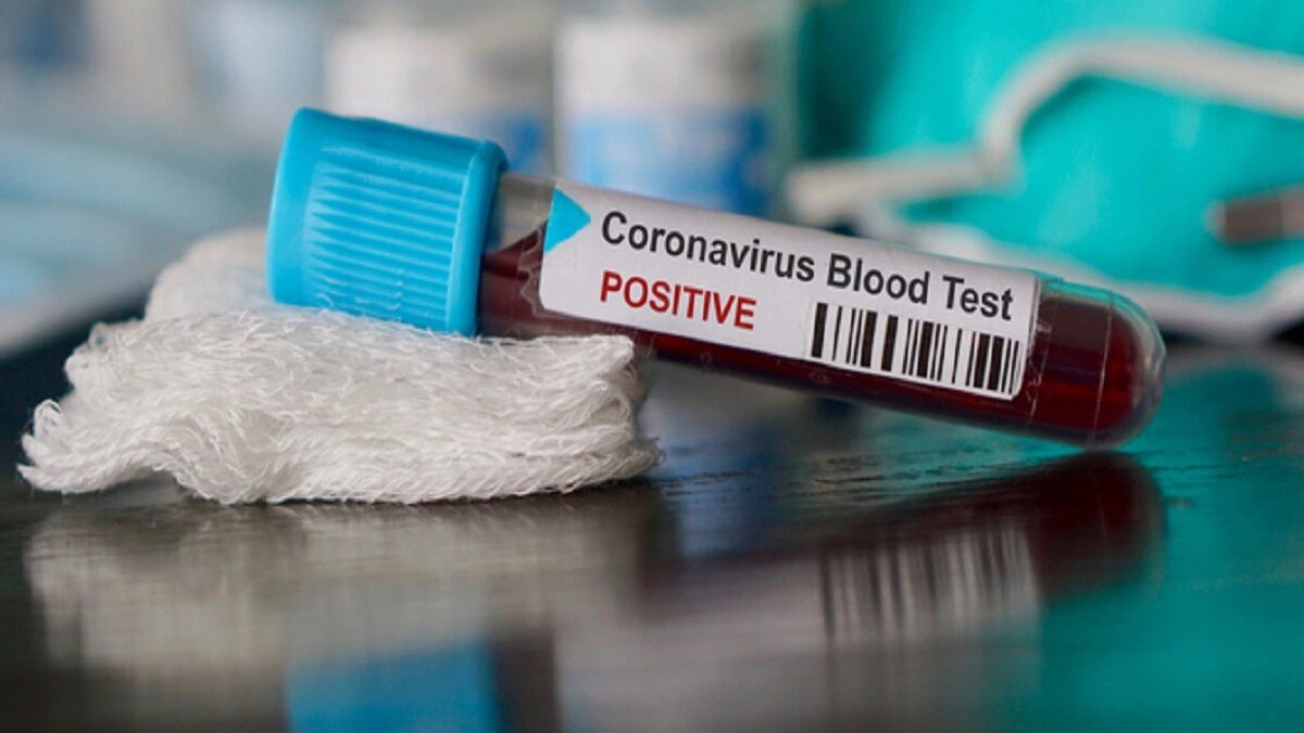 Click to enlarge coronavirus test positive
