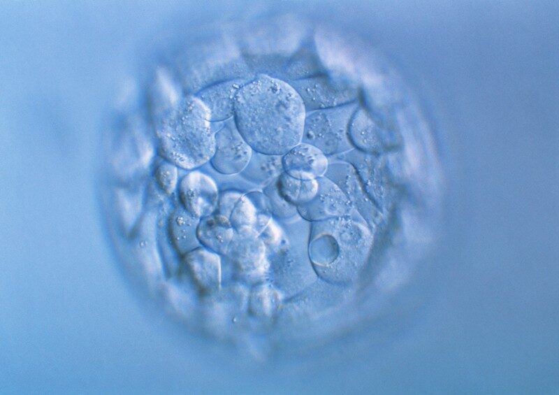 human embryo