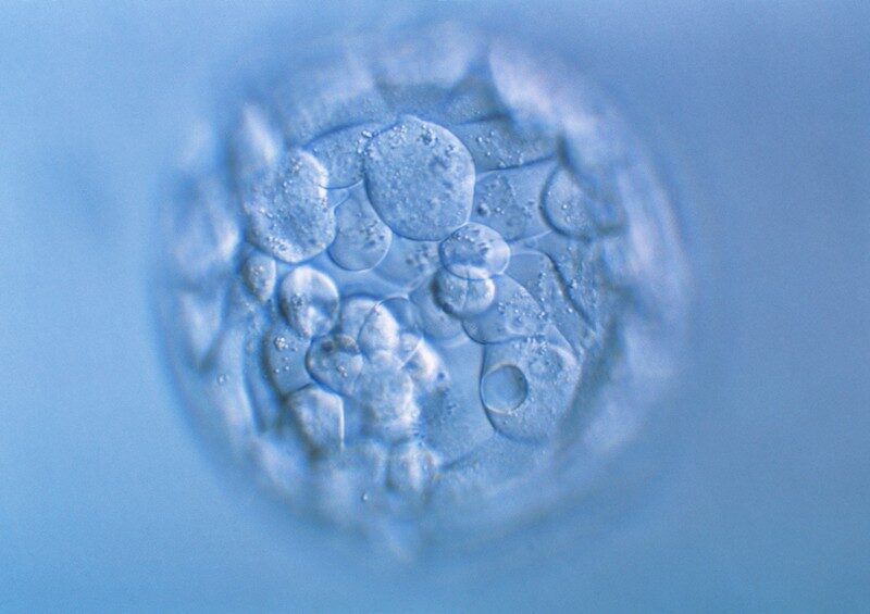 Click to enlarge human embryo