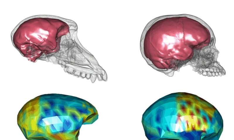 Click to enlarge brain