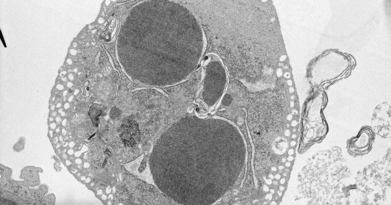 cell death