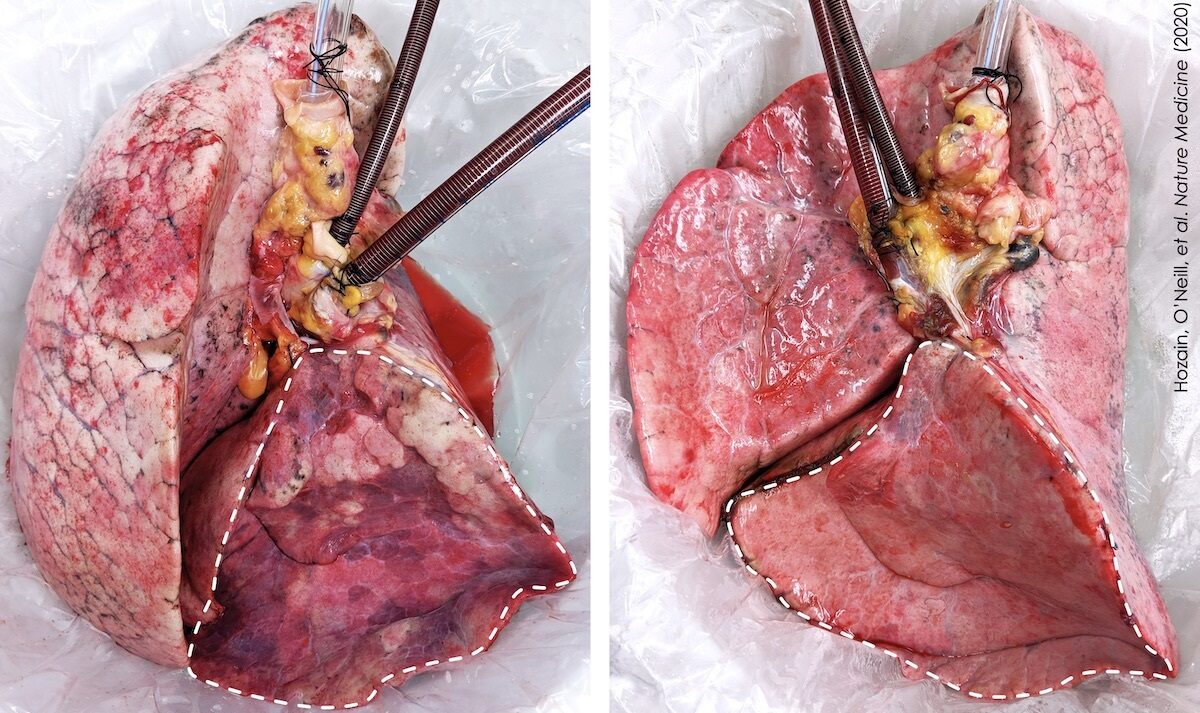 Human Lung