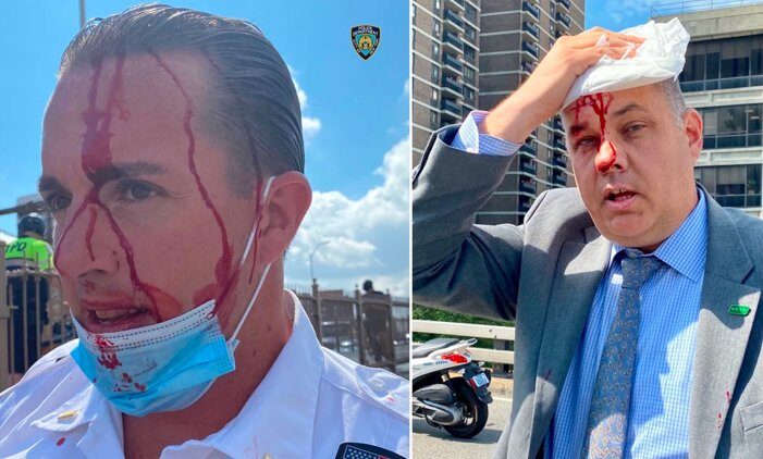 Click to enlarge two injured