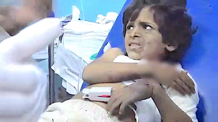 Injured child