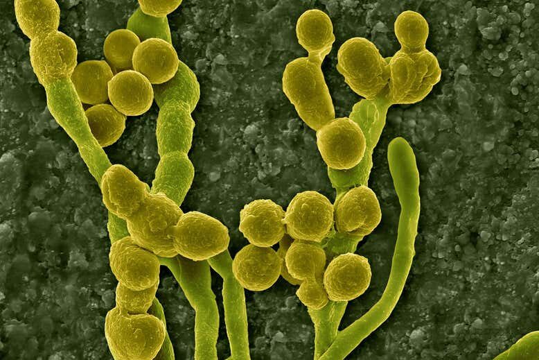 Click to enlarge mould chernobyl