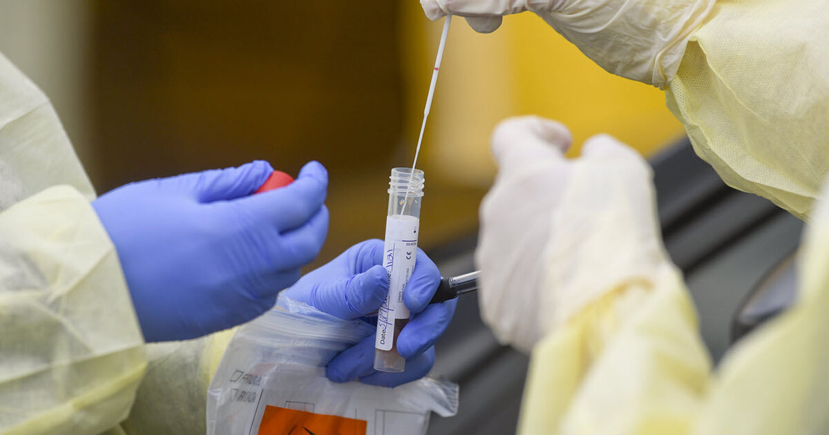 Lab test