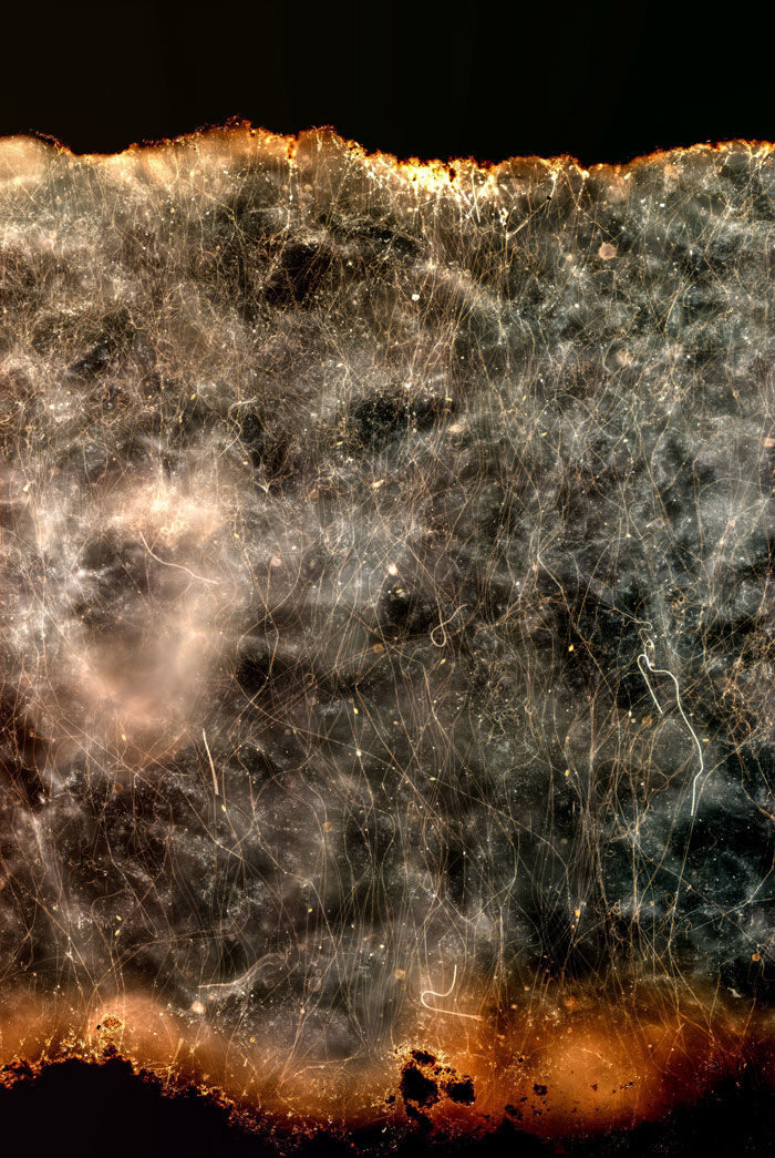 Click to enlarge bacteria