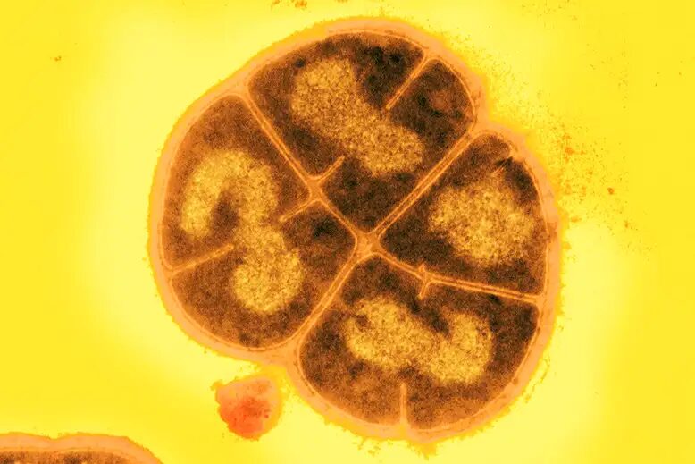 Click to enlarge Deinococcus radiodurans