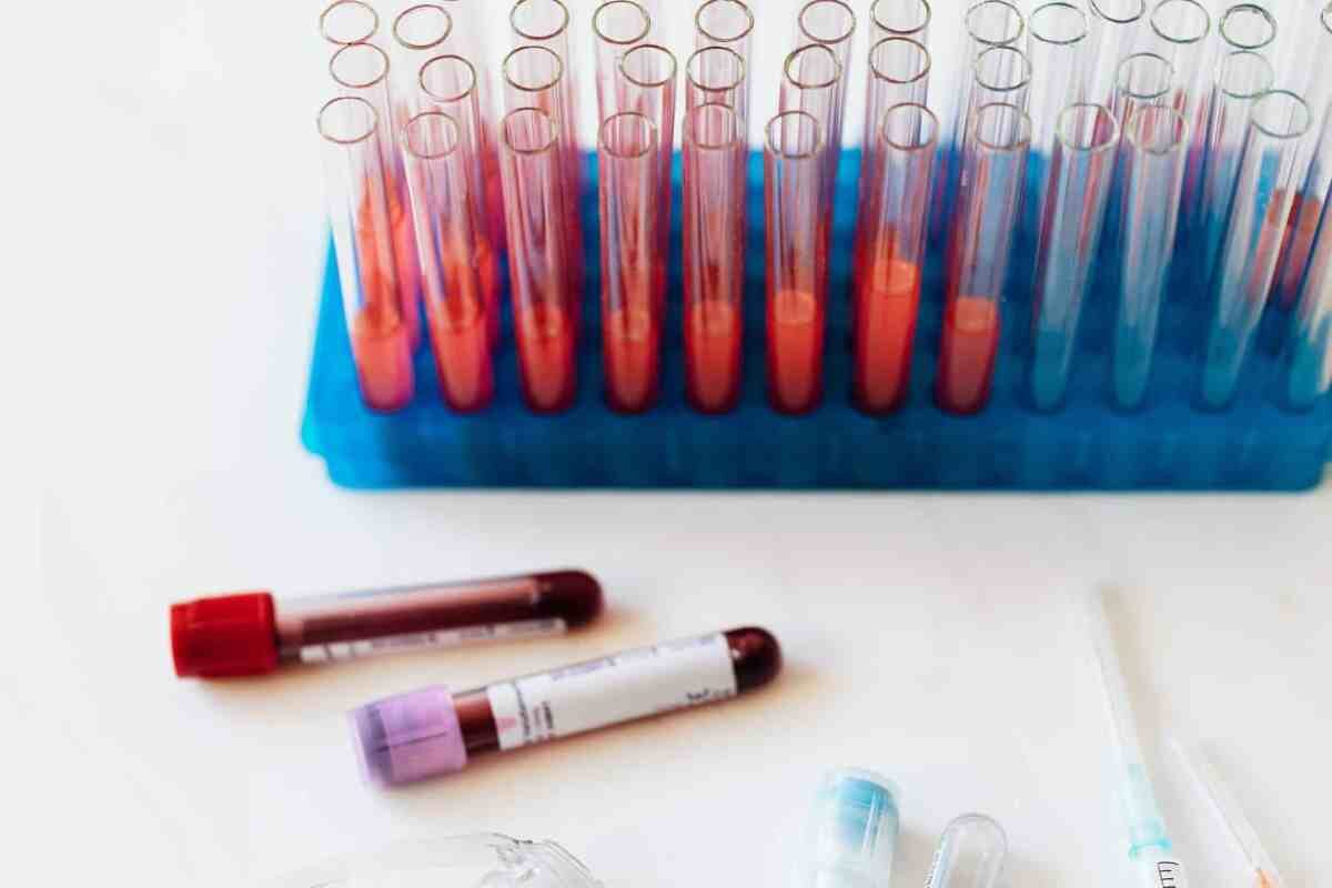 Blood Test