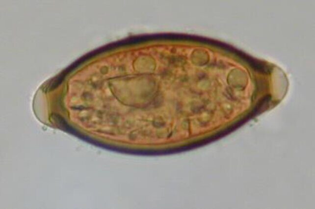 Click to enlarge Trichuris trichiura