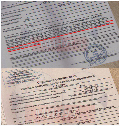 Click to enlarge navalny hospital report