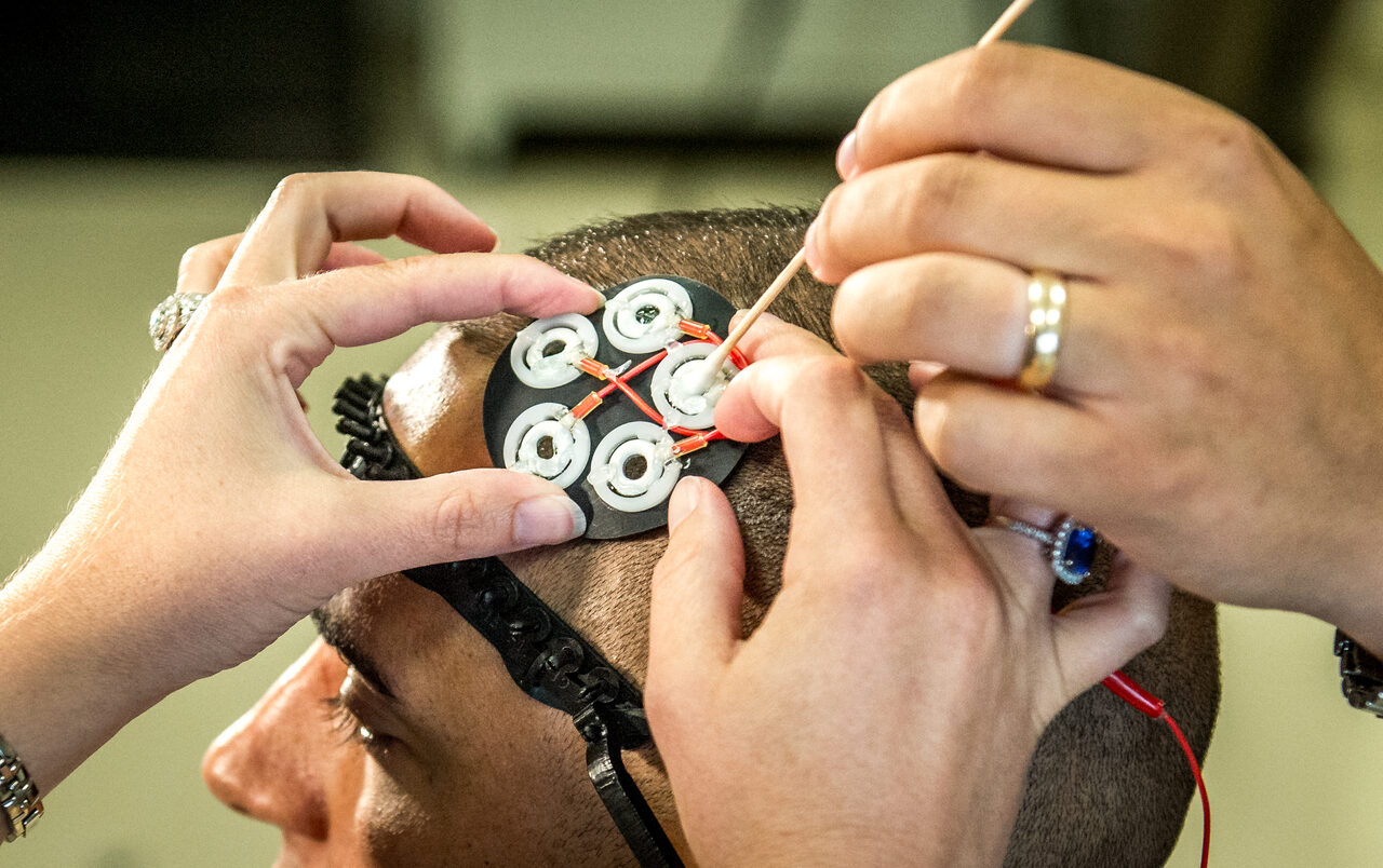 low dose electrical stimulation brain