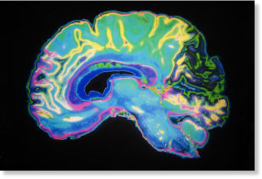 brain on sleep