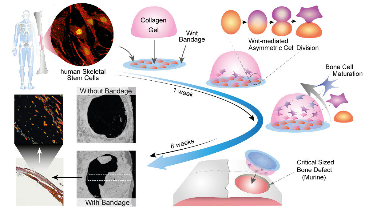 Click to enlarge Bandage Healing