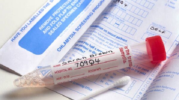 Chlamydia test