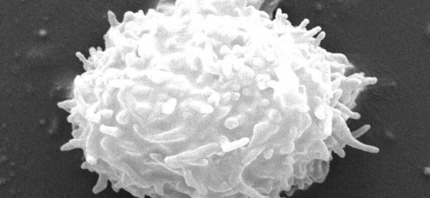 acanthamoeba