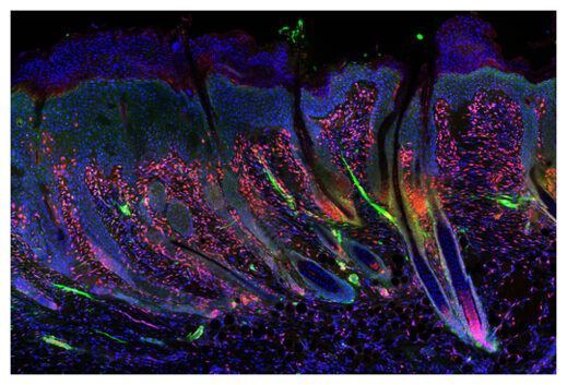 Click to enlarge Regenerating Skin