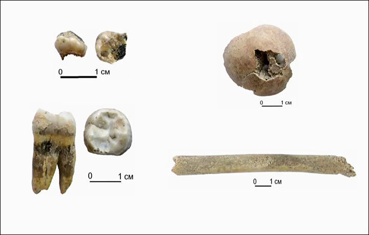 Click to enlarge milk tooth siberia