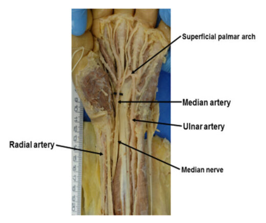Median Artery