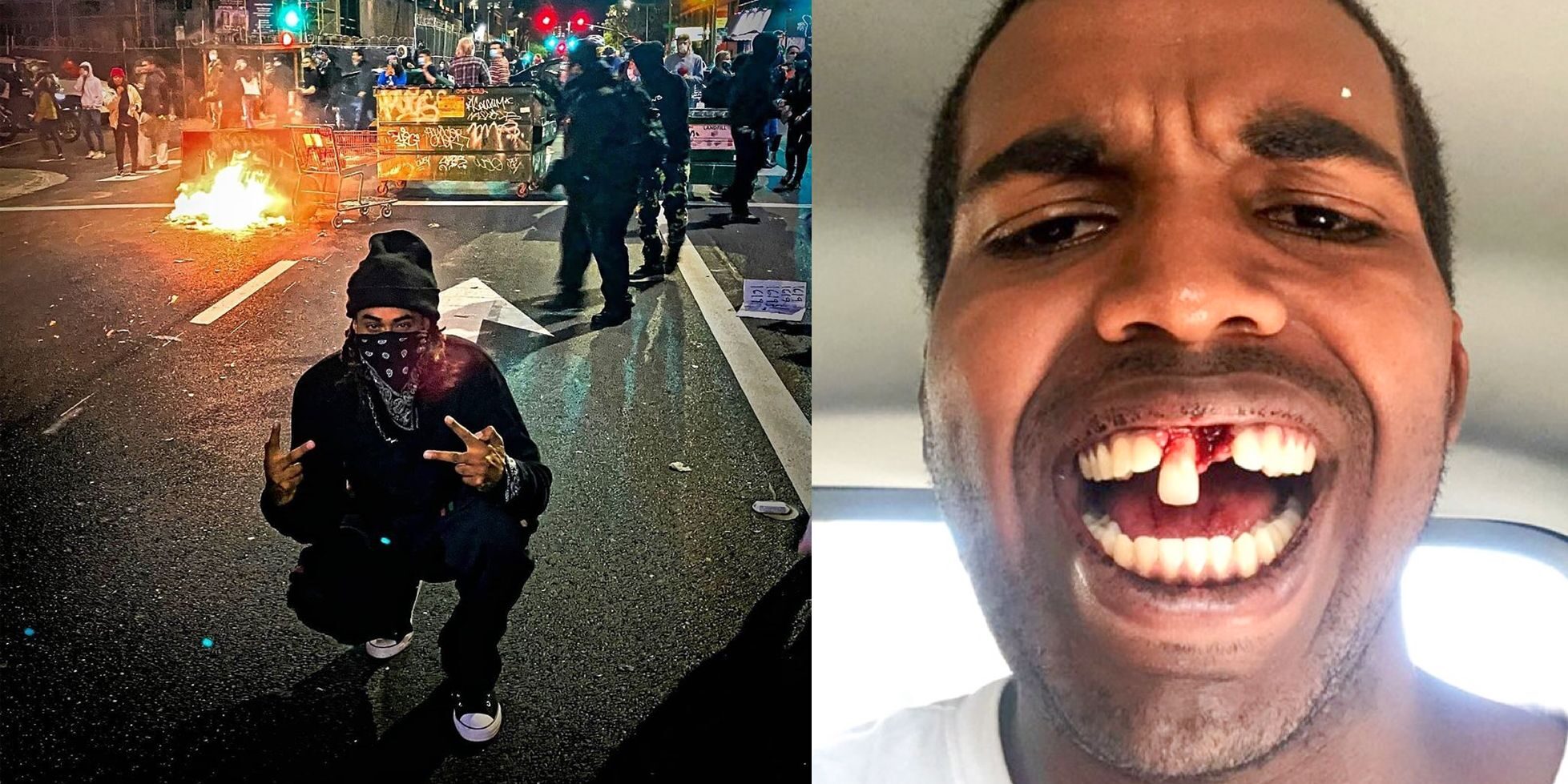 Click to enlarge Androa Anderson Philip hate crime