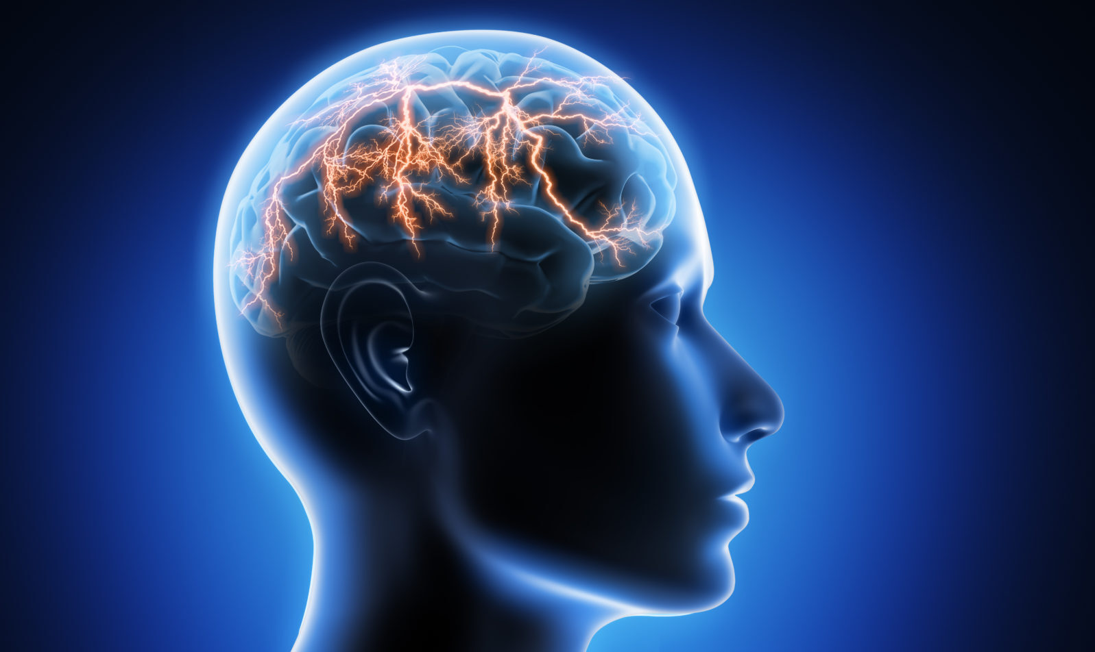 Epilepsy