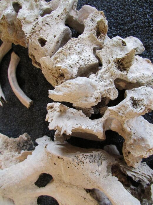 spine