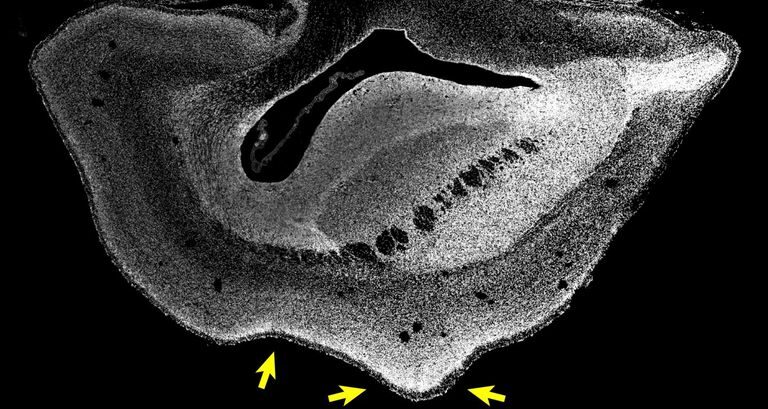 Click to enlarge Slice of Brain